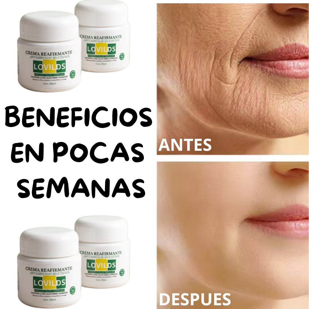 👑 CREMA REAFIRMANTE LOVIDS💜