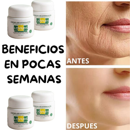 👑 CREMA REAFIRMANTE LOVIDS💜