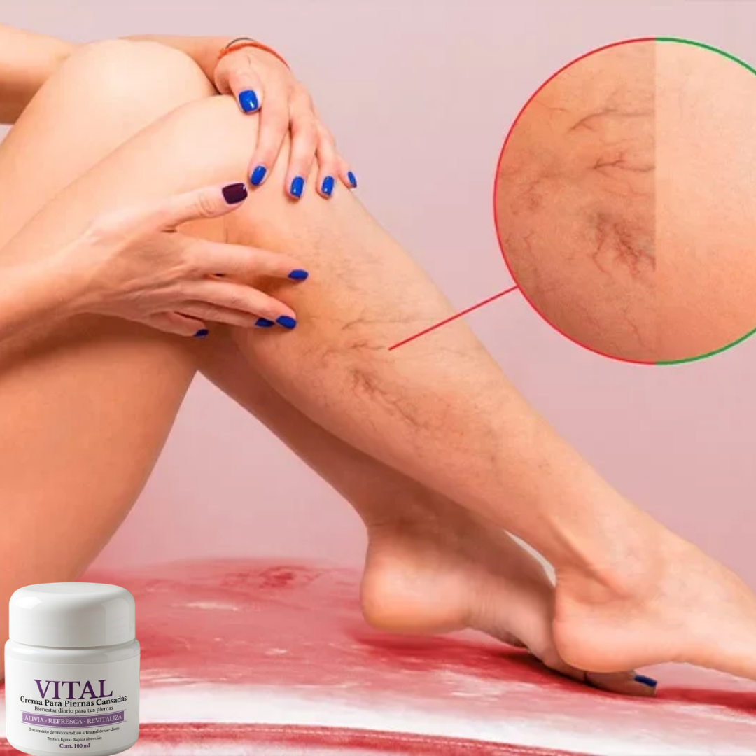 🦵 VITAL Crema para Piernas Cansadas ❄️
