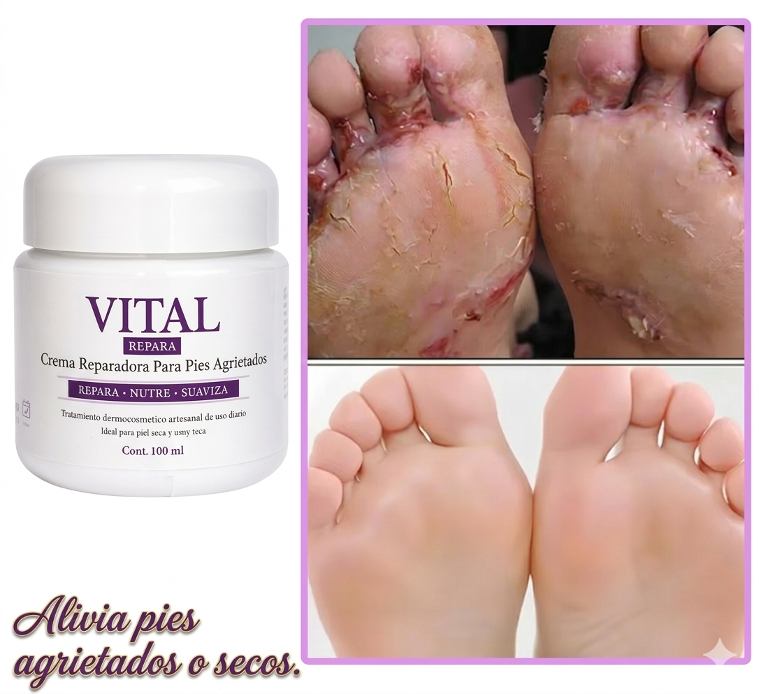 VITAL REPARA Crema para Pies Secos y Agrietados 💧
