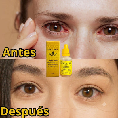 OFTALMIEL🐝Gotas mágicas