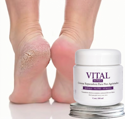 VITAL REPARA Crema para Pies Secos y Agrietados 💧