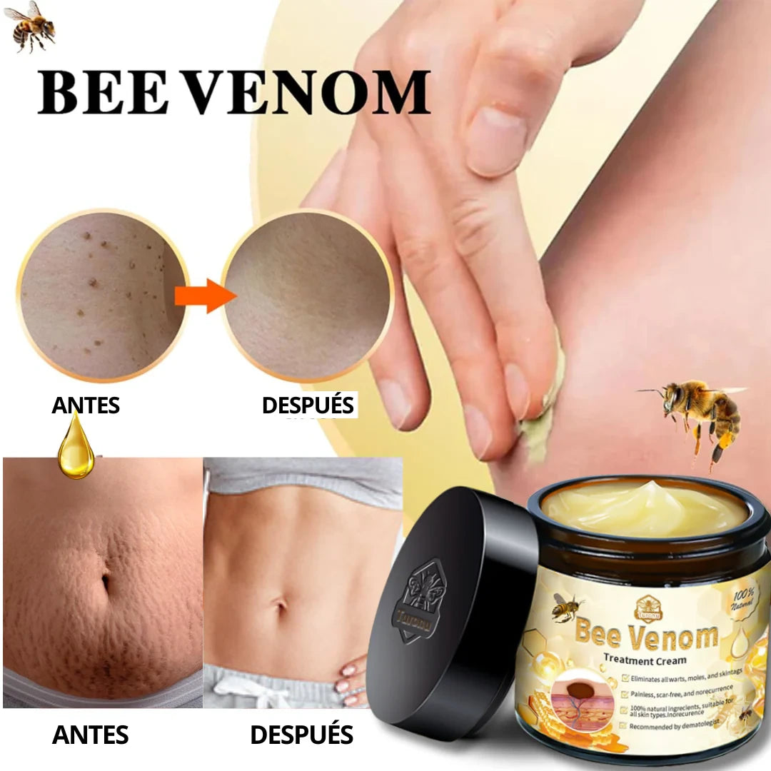 💖BEE VENOM MANCHAS🌺✨