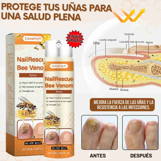 SPRAY BEE VENOM🐝 NO MÁS HONGOS💅🏻