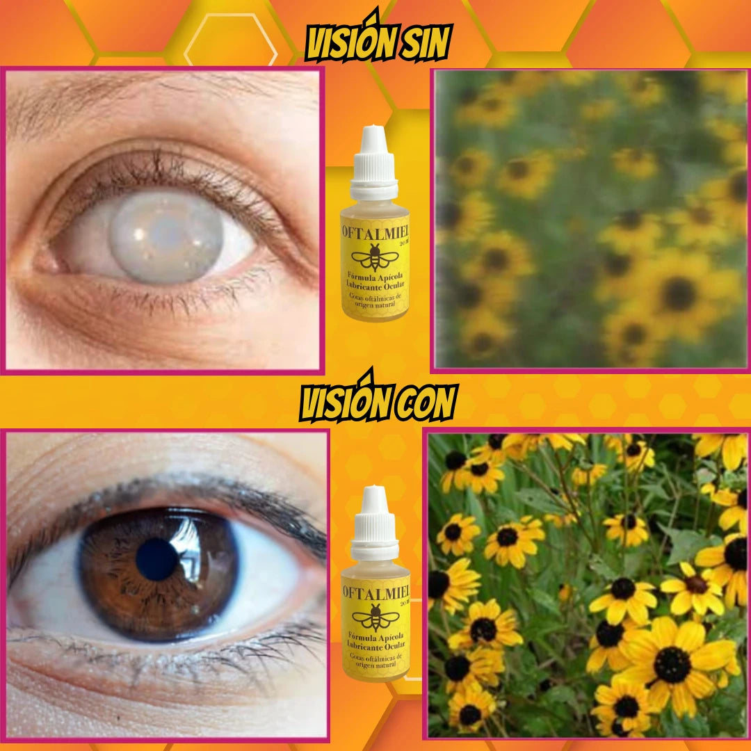 OFTALMIEL🐝Gotas mágicas