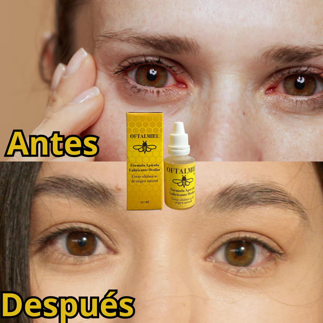 OFTALMIEL🐝Gotas mágicas