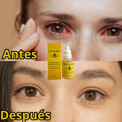 OFTALMIEL🐝Gotas mágicas